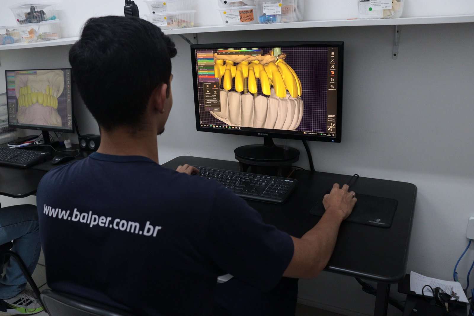 Fluxo digital e CAD/CAM